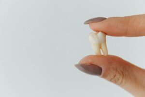 Extraccion dental